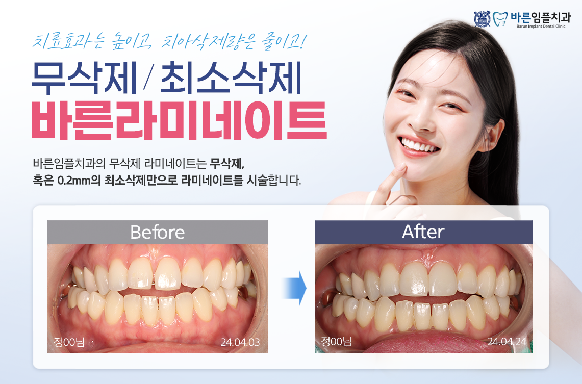 바른라미네이트